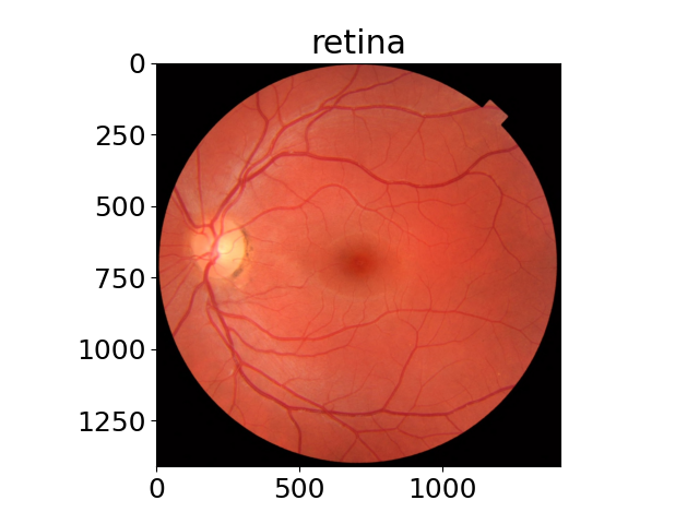 retina