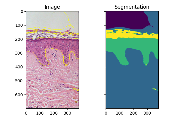 Image, Segmentation